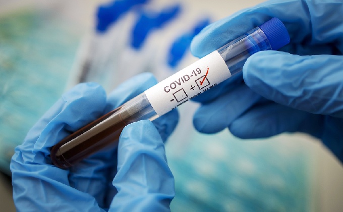 В Когалыме работает горячая линия по вопросам тестирования на коронавирус